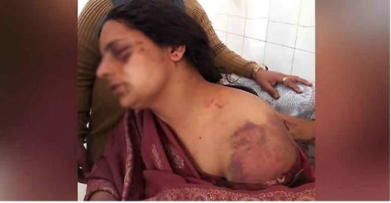 सैनिकले श्रीमतीलाई कुटेर यस्तो हालत बनाएपछि…