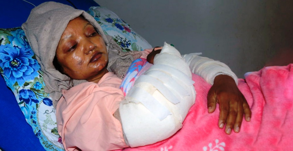प्रहरीमाथि सांसद सहितको भीडले पेट्रोल छर्केर आगो लगाएपछि