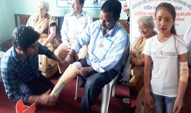 कृत्रिम हातखुट्टा पाउँदा सबै दङ्ग