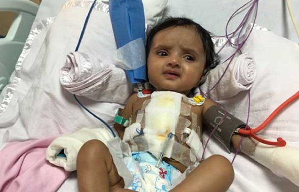 दुई महिनामा २० पटक हृदयघात भएकी बच्ची
