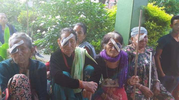 एक सय छ वर्षीयको मोतियाविन्दुको शल्यक्रिया