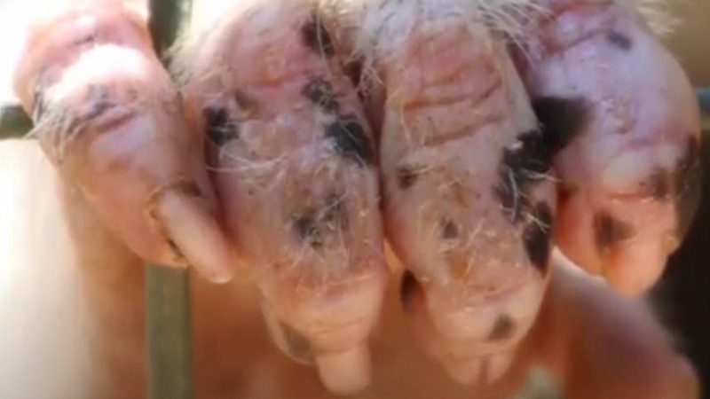 नेपालमा भेटियाे ‘मंकीपक्स’ टेकुमा उपचार हुँदै